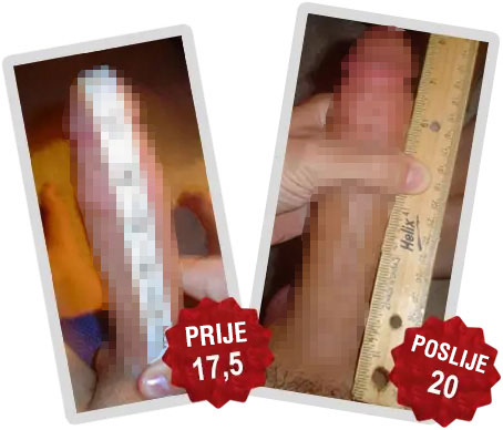Titan Gel iskustva - povecanje spolnog organa