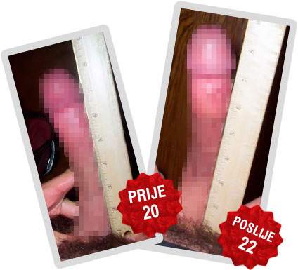 Titan Gel iskustva - za povecanje penisa