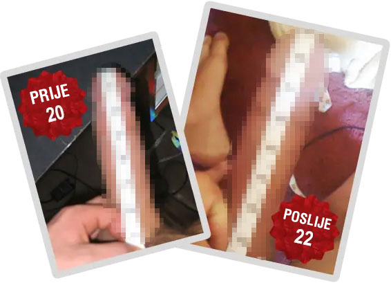 Titan Gel iskustva - krema za povecanje penisa